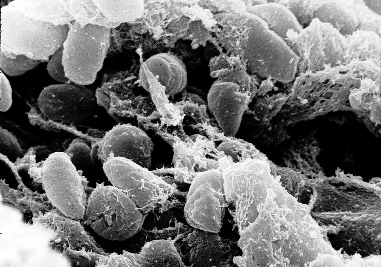 Sempat Disebut Pes, Rusia Kini Klaim Laboran 28 Tahun di Irkutsk Tewas karena Pneumonia